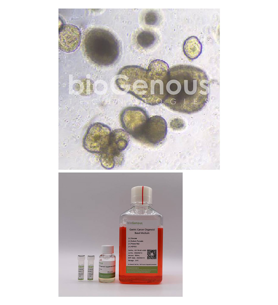 Gastric Cancer Organoid Kit胃癌