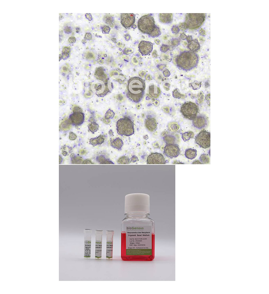 Neuroendocrine Neoplasm Organoid Kit神经内分泌细胞癌