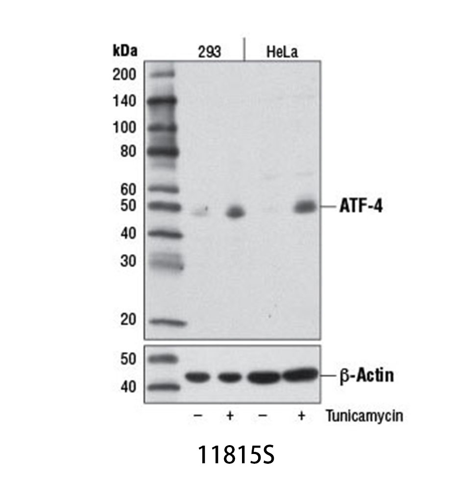 ATF-4 (D4B8) Rabbit mAb