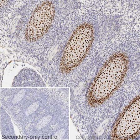 Anti-Sp7 / Osterix antibody - ChIP Grade
