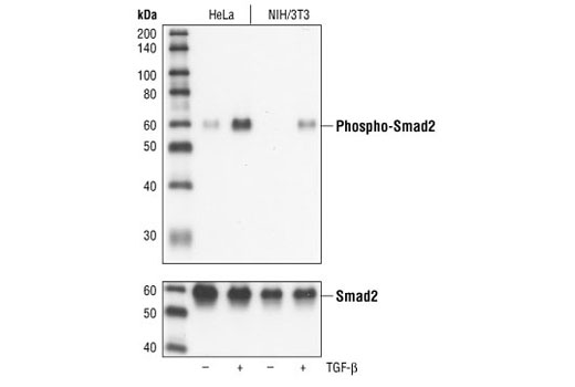 Smad2/3 Antibody Sampler Kit