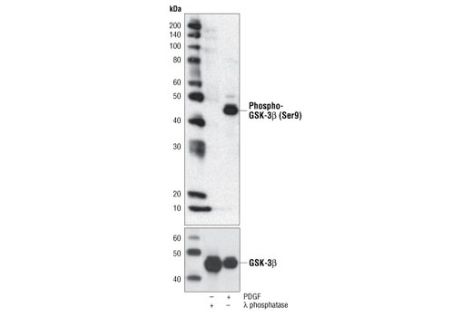 Phospho-GSK-3β (Ser9) (5B3) Rabbit mAb
