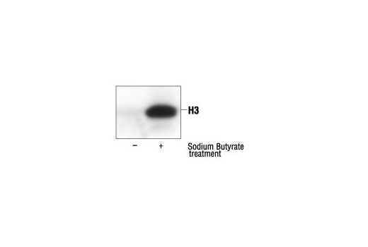 Acetylated-Lysine Antibody