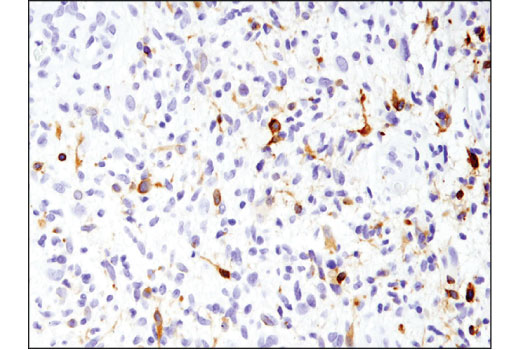 EGF Receptor vIII (D6T2Q) XP Rabbit mAb