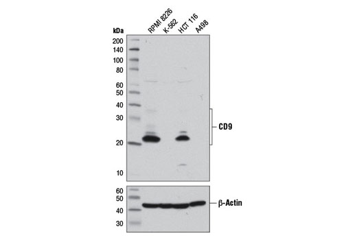 CD9 (D8O1A) Rabbit mAb