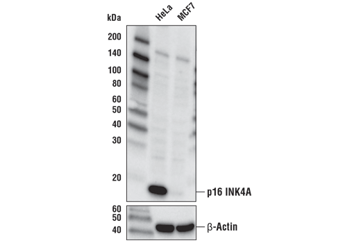 p16 INK4A (D7C1M) Rabbit mAb