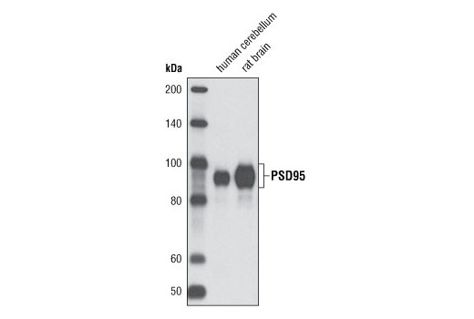 PSD95 (D27E11) XP Rabbit mAb
