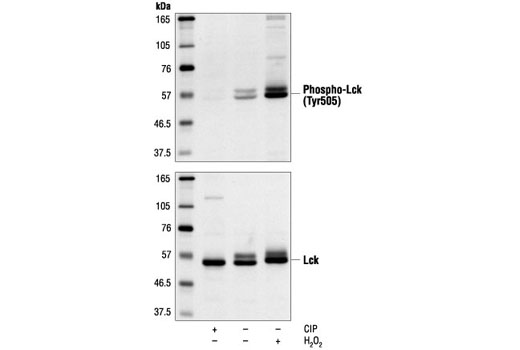 Lck Antibody