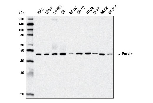 α-Parvin (D7F9) XP Rabbit mAb