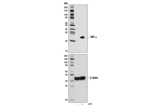 TNF-α (D1G2) Rabbit mAb (IF/Flow Preferred)