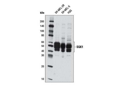 SGK1 (D27C11) Rabbit mAb