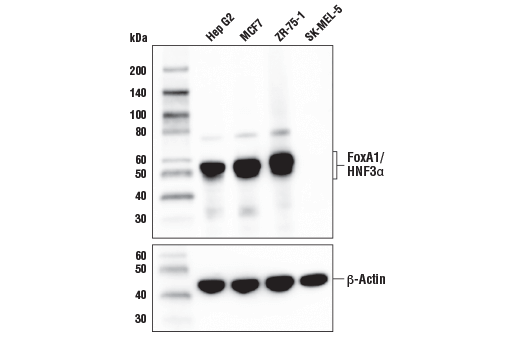 FoxA1/HNF3α (E7E8W) Rabbit mAb