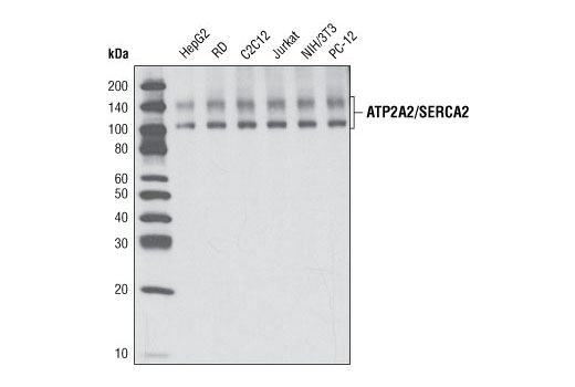 ATP2A2/SERCA2 Antibody