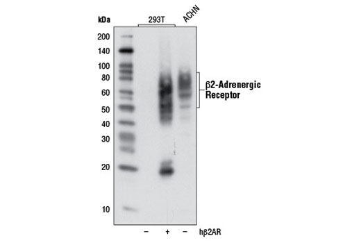 β2-Adrenergic Receptor (D6H2) Rabbit mAb