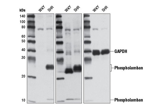 Phospho-Phospholamban (Ser16/Thr17) Antibody
