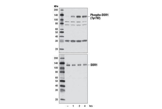 Phospho-DDR1 (Tyr792) Antibody