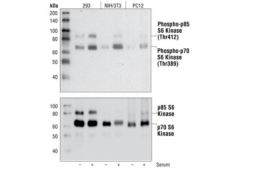 Phospho-p70 S6 Kinase (Thr389) (108D2) Rabbit mAb