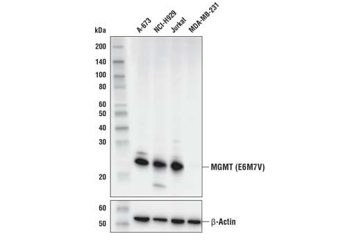 MGMT (E6M7V) Rabbit mAb