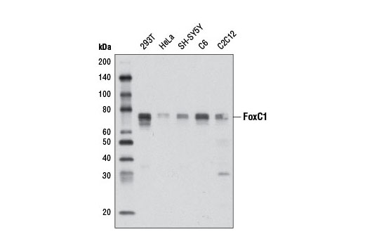 FoxC1 (D8A6) Rabbit mAb