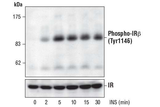 Phospho-Insulin/IGF Receptor Antibody Sampler Kit