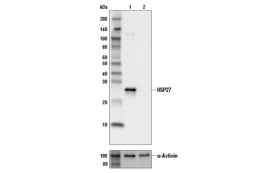HSP27 (E1J4D) Rabbit mAb (IHC Preferred)