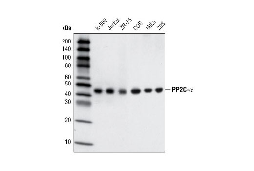 PP2C-α (D18C10) XP Rabbit mAb