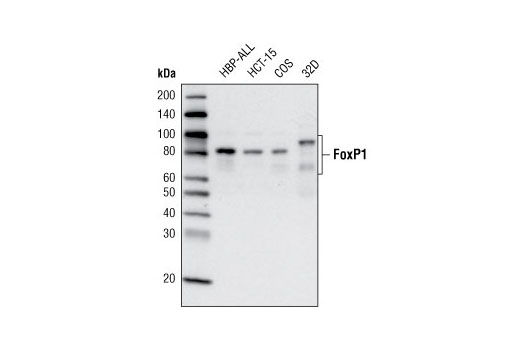 FoxP1 (D35D10) XP Rabbit mAb