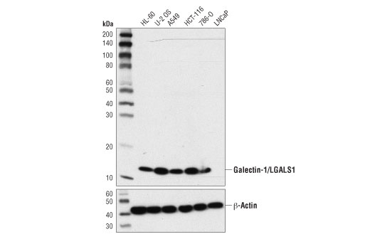 Galectin-1/LGALS1 (8A12) Mouse mAb