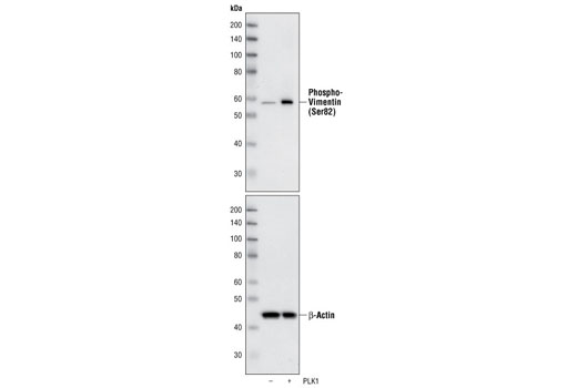 Phospho-Vimentin (Ser83) Antibody