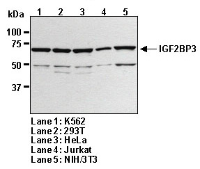 Anti-IGF2BP3 (IMP3) pAb