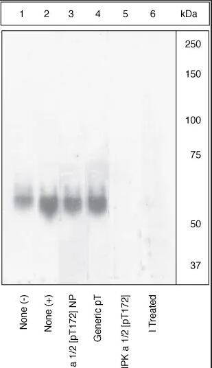 Anti-AMPK alpha 1 (phospho T183) + AMPK alpha 2 (phospho T172) antibody