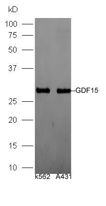生长分化因子15/巨嗜细胞抑制因子1抗体
