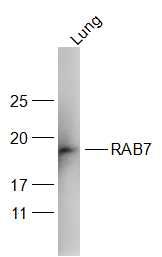 RAS癌基因相关蛋白RAB7抗体