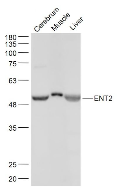 核苷转运蛋白ENT2抗体