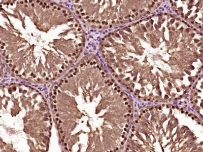 磷酸化细胞周期检测点激酶2抗体