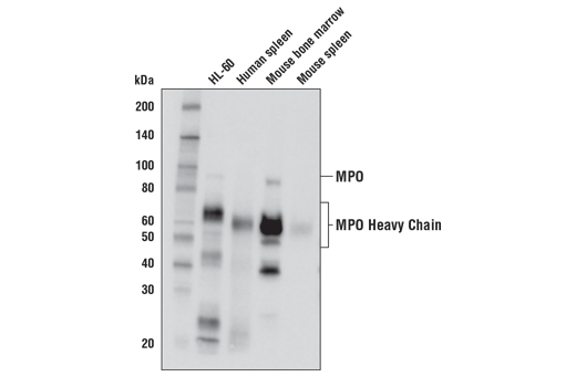 Myeloperoxidase Antibody