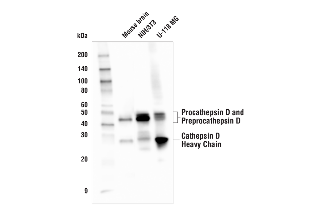 Cathepsin D (E179) Antibody