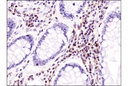 CXCR4 (D4Z7W) Rabbit mAb (IHC Specific)