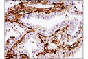 Fascin (55K-2) Mouse mAb (IHC Formulated)