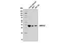 AKR1C2 Antibody