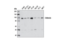 Non-Homologous End Joining (NHEJ) DNA Repair Antibody Sampler Kit